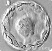 北京供卵去哪里找_孕妈课堂 - 专业人士带您走进试管婴儿，看看那些发生在“